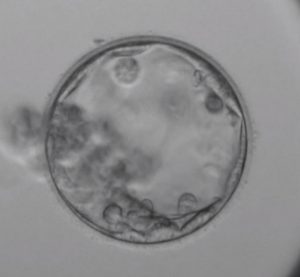 胚盤胞細胞なし