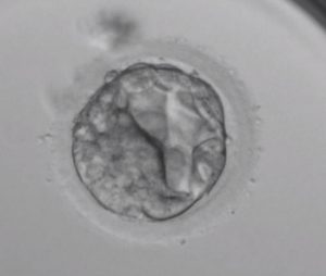 胚盤胞BL-1